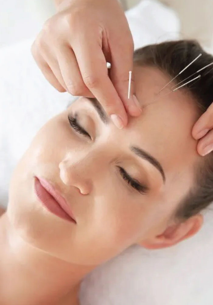 phenom services Facial Rejuvenation Acupuncture V2 700x1000 1